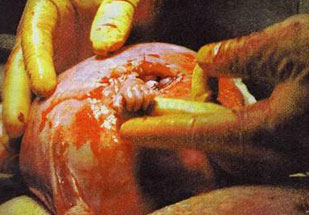 The tiny hand of Samuel Alexander Armas
